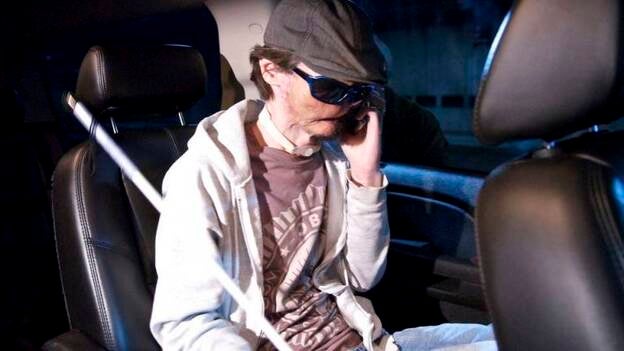 Un hombre de 25 años recibe el primer trasplante total de cara en Estados Unidos