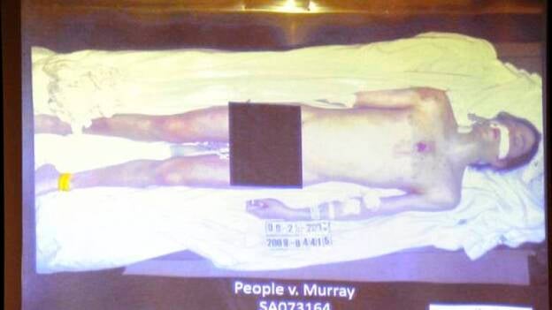 El forense resta crédito a la teoría de que Jackson provocara su propia muerte