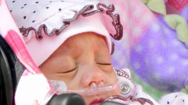 Dan de alta a bebé hispana considerada una de las más pequeñas en sobrevivir