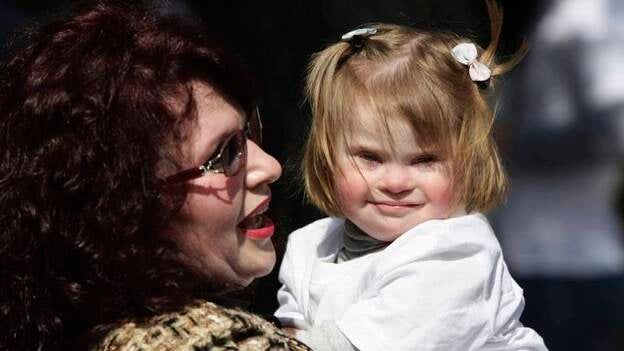 "Tengo síndrome de Down. No estoy enfermo, solo tengo un cromosoma de más"