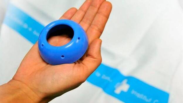 La inserción de un anillo en el útero reduce en un 75% los partos prematuros