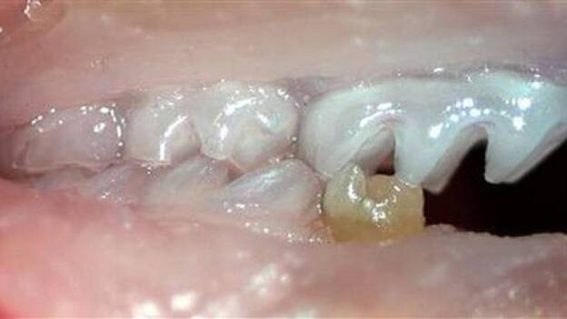 Científicos hacen crecer un diente a partir de células humanas y de ratón