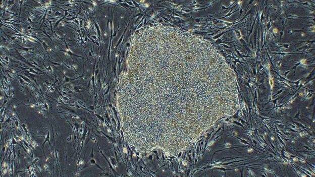 Comienza en Japón el primer ensayo de células iPS en humanos de la historia