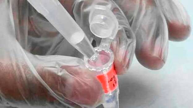 Un gel microbicida permite prevenir la transmisión sexual del VIH hasta 24 horas