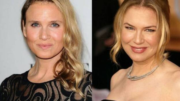 Los cambios de Renée Zellweger