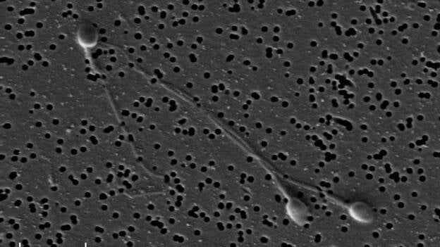 Científicos crean células precursoras de óvulos y espermatozoides humanos
