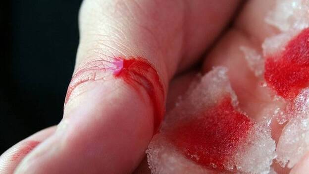 Descubren una célula responsable de la cicatrización y el crecimiento del cáncer de piel