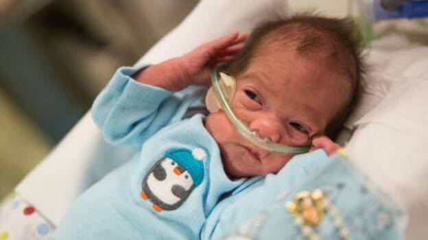 Nace un bebé después de que su madre sufriera muerte cerebral 54 días