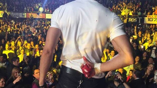 Enrique Iglesias será operado de la mano en la que sufrió cortes con un dron