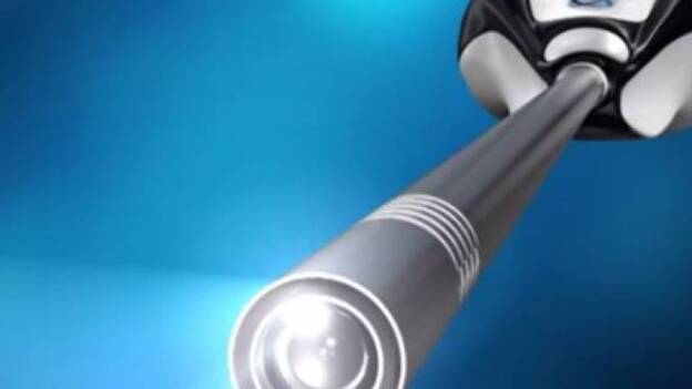 Diseñan una cámara 3D que permite operar en el interior del cerebro