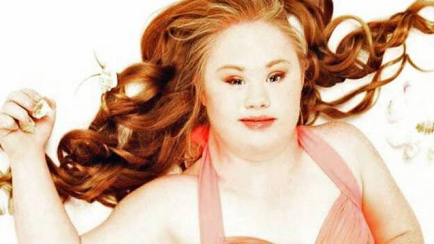 Una modelo con Síndrome de Down busca conquistar la pasarela de Nueva York