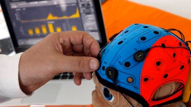 Alzheimer, ictus y párkinson, dolencia neurológicas más buscadas en Internet