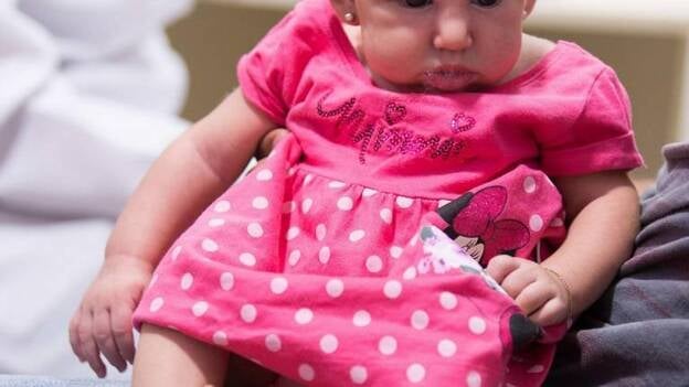 ¿Microcefalia en bebés por culpa del Zika?