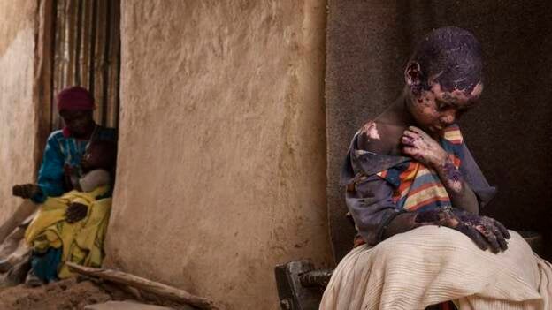 Imágenes premiadas del World Press Photo