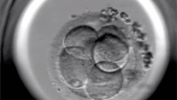 La implantación de varios embriones no aumenta las probabilidades de embarazo pero sí los riesgos