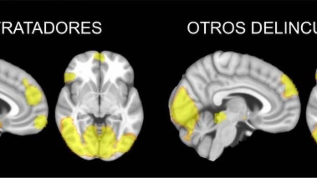 El cerebro de hombres maltratadores funciona de modo distinto al de otros delincuentes