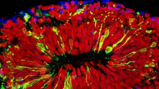 Sofisticados "mini-cerebros" añaden evidencia del daño del virus en la corteza cerebral del feto