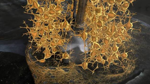 Una nueva técnica puede llevar a mejores trasplantes de células contra la enfermedad de Parkinson