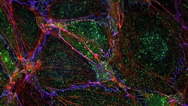 Identifican una proteína que "debilita" la barrera interna de los vasos sanguíneos durante las inflamaciones