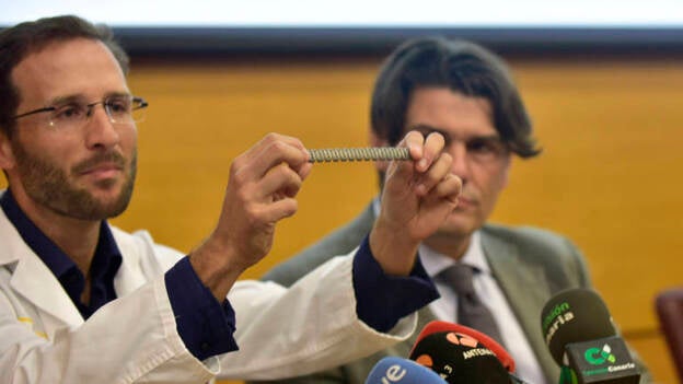 Implantan en Gran Canaria la primera reconstrucción de pared torácica "3D"