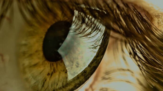 Los oftalmólogos advierten que el número de miopes se habrá doblado en 2050