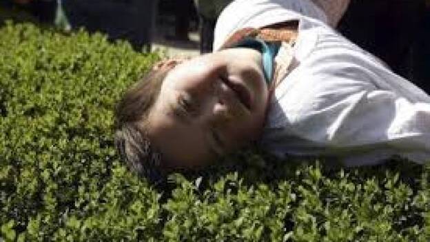 Se abre una vía a una posible terapia para el síndrome de Down