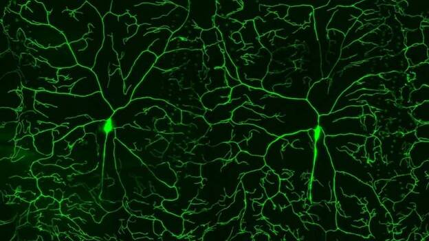 Científicos hallan 36 genes que juegan un papel en la sensibilidad de los nervios