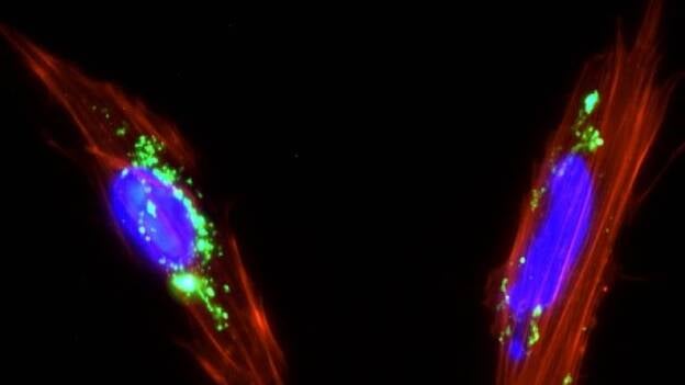 Utilizan células madre de placenta como vehículo para llevar fármacos al interior de los tumores