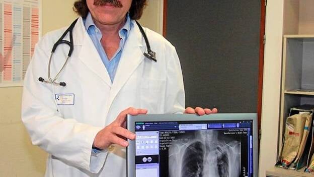 José Antonio Caminero: "Falta un plan que controle al paciente con tuberculosis"