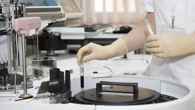 Estudian una proteína vinculada a la diabetes tipo 2 para explicar la resistencia en las personas obesas