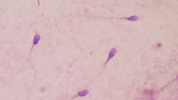 El 34% de las mujeres que necesitan una terapia de fertilidad para quedarse embarazadas sufren alternaciones del sueño