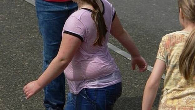 Los científicos se plantean adelantar a los 16 años la cirugía por obesidad