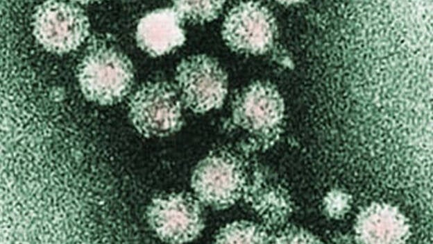 Investigadores españoles demuestran que los antivirales curan hepatitis B en pacientes coinfectados con VIH