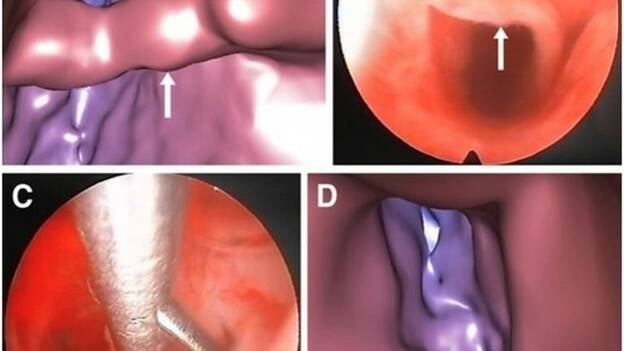 Investigadores españoles desarrollan un nuevo método que detecta anomalías responsables de la infertilidad