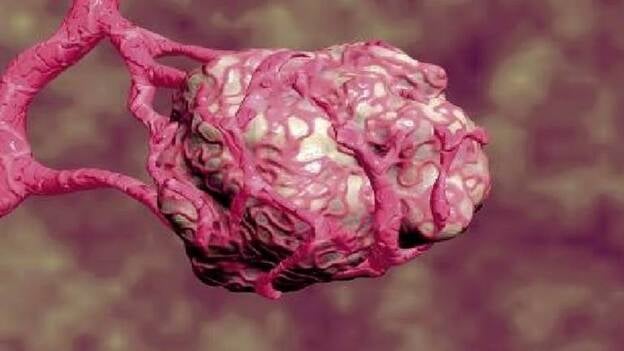 Sanidad autoriza el primer medicamento biológico contra el cáncer de cérvix