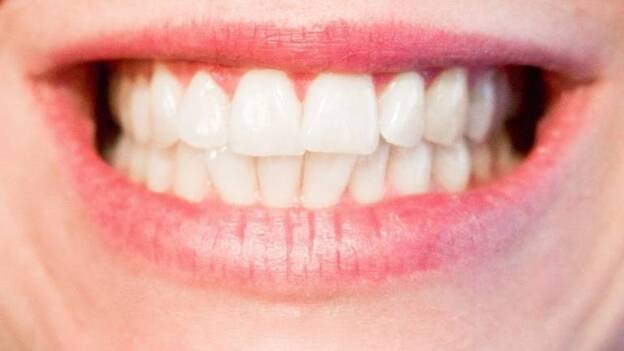 Más de la tercera parte de las personas con VIH tiene problemas orales por el debilitamiento de su sistema inmune