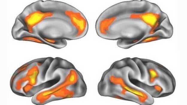 Demuestran que el embarazo modifica el cerebro de las mujeres