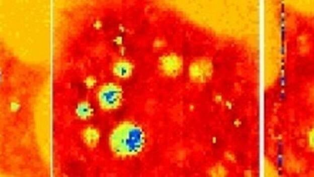 El sonido permite ver dentro de células vivas por primera vez