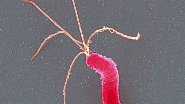 Descubren una nueva vía para desarrollar fármacos que ataquen la 'Helicobacter pylori'