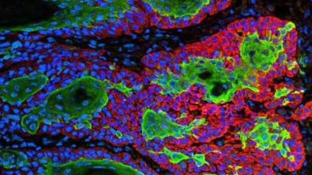 Manipular el espectro de la luz permitirá atacar los tumores con nanopartículas