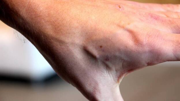 Una empresa que implanta chips a sus trabajadores: "No somos Gran Hermano"