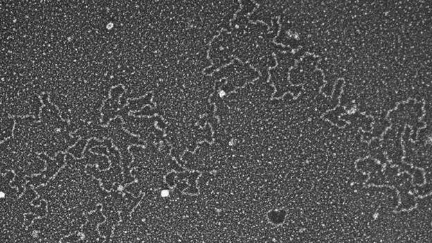 Las proteínas del moco de los pulmones se despliegan de manera errónea en la fibrosis quística