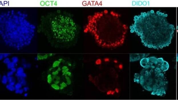 Científicos españoles descubren un 'interruptor' molecular que indica a las células madre cuándo deben diferenciarse