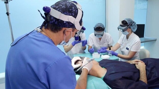 El trasplante capilar, con médicos especializados