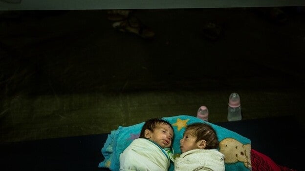 Un gemelo es más listo que el otro