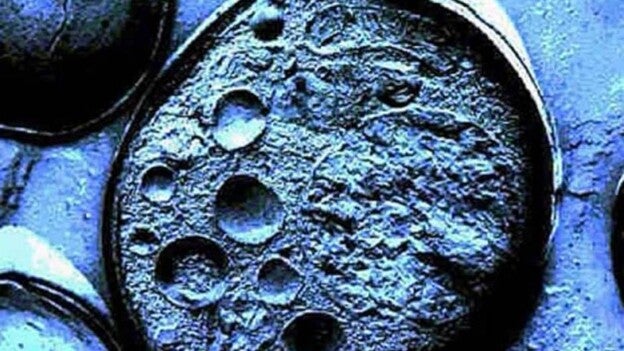 Primeros test clínicos con un fármaco con células iPS