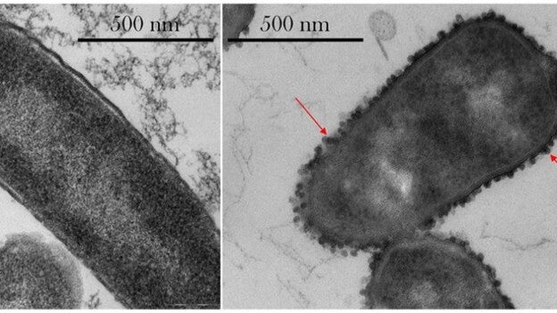 Bacterias cambian de aspecto en el espacio para hacerse resistentes