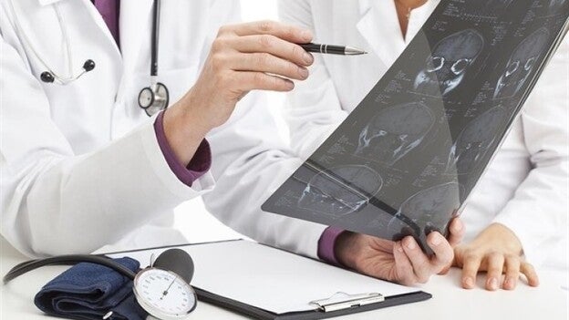 Hasta un 90% de los casos de ictus se podrían evitar