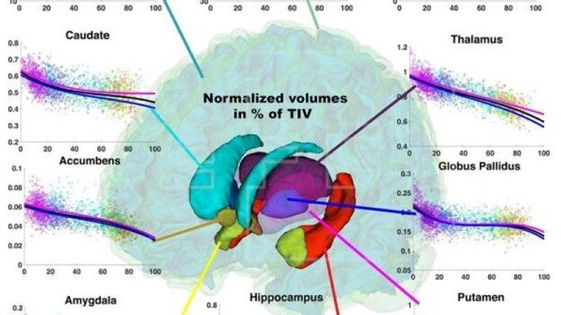 El cerebro del hombre envejece peor que el de la mujer