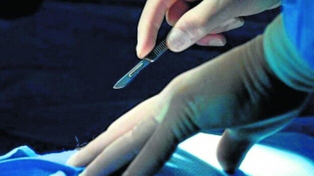 El donante vivo de riñón es mujer